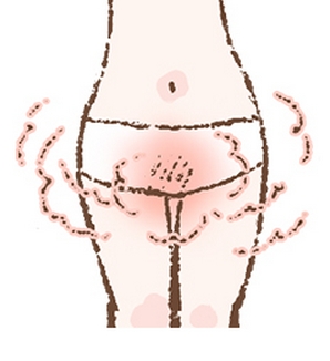 �f���P�[�g�]�[���̃j�I�C�ƍ����ݑ΍�R�X��